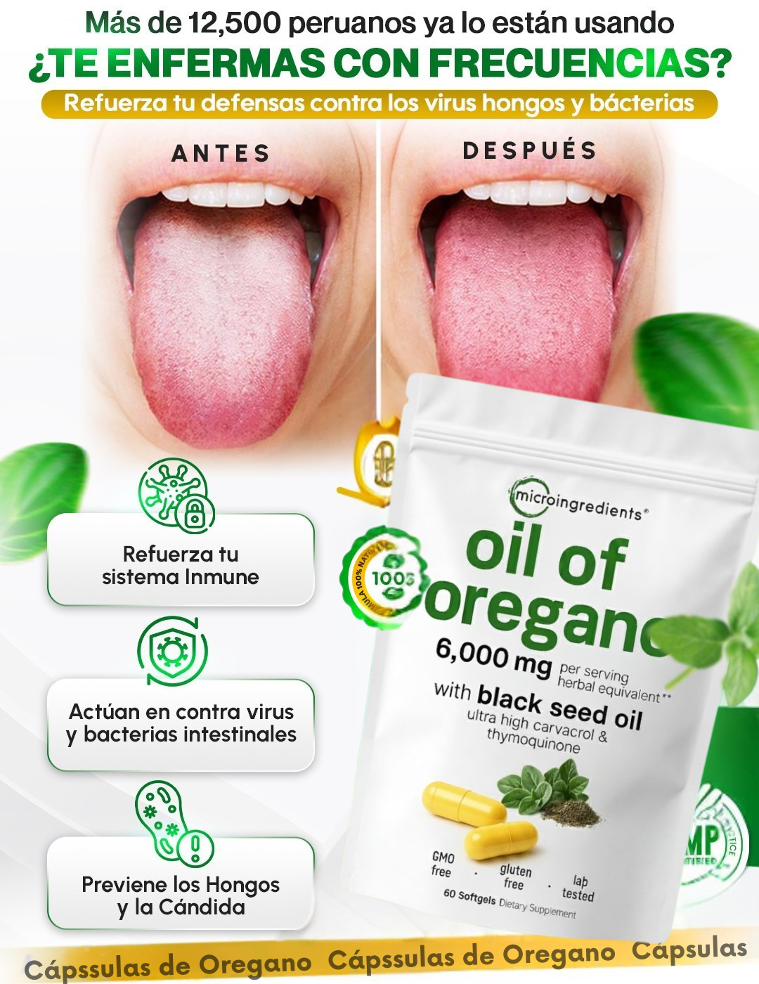 ACEITE DE OREGANO| ELIMINA HONGOS DE TU CUERPO
