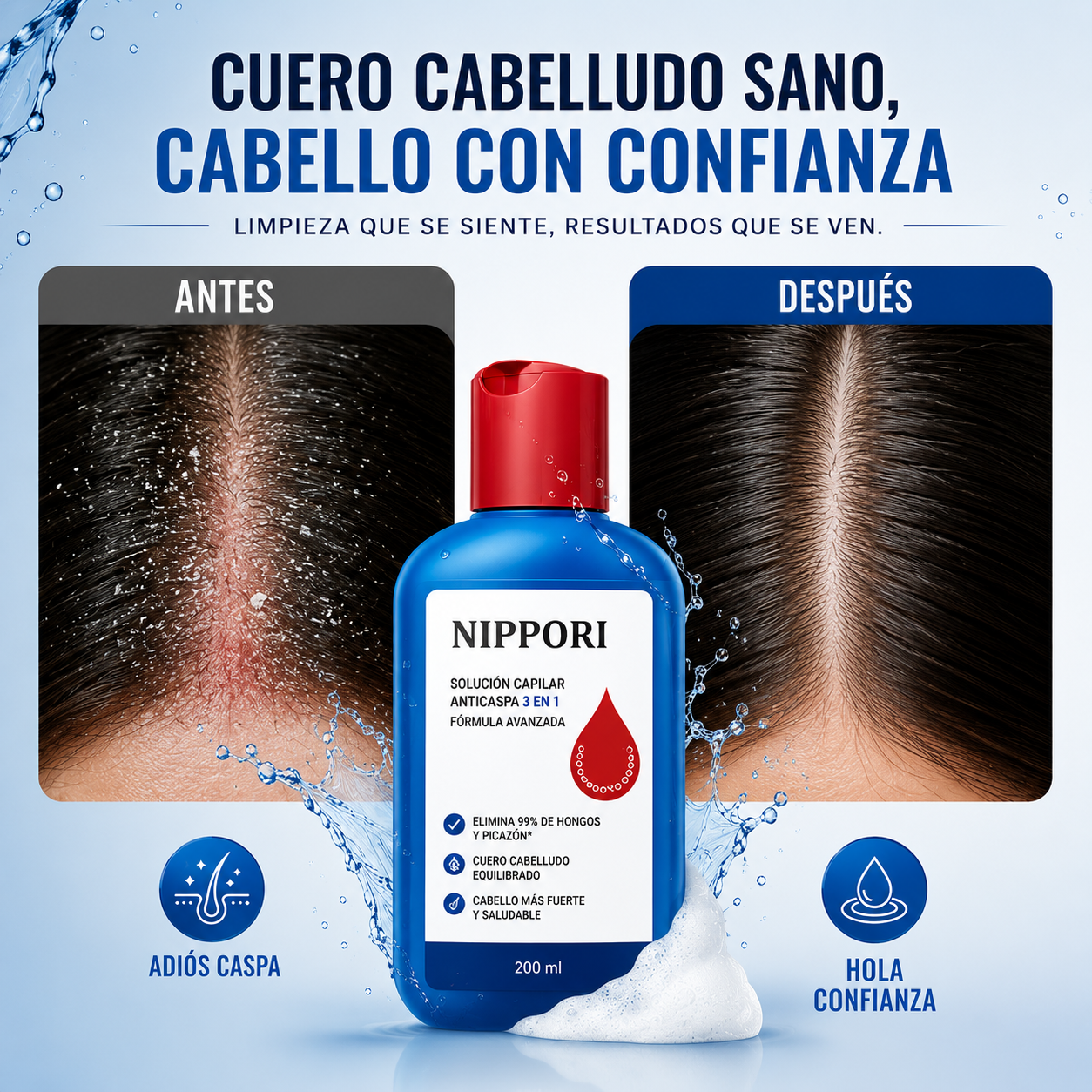 Shampoo NIPPORI 120ml™ | Elimina Caspa, Hongos, Picazón y grasa