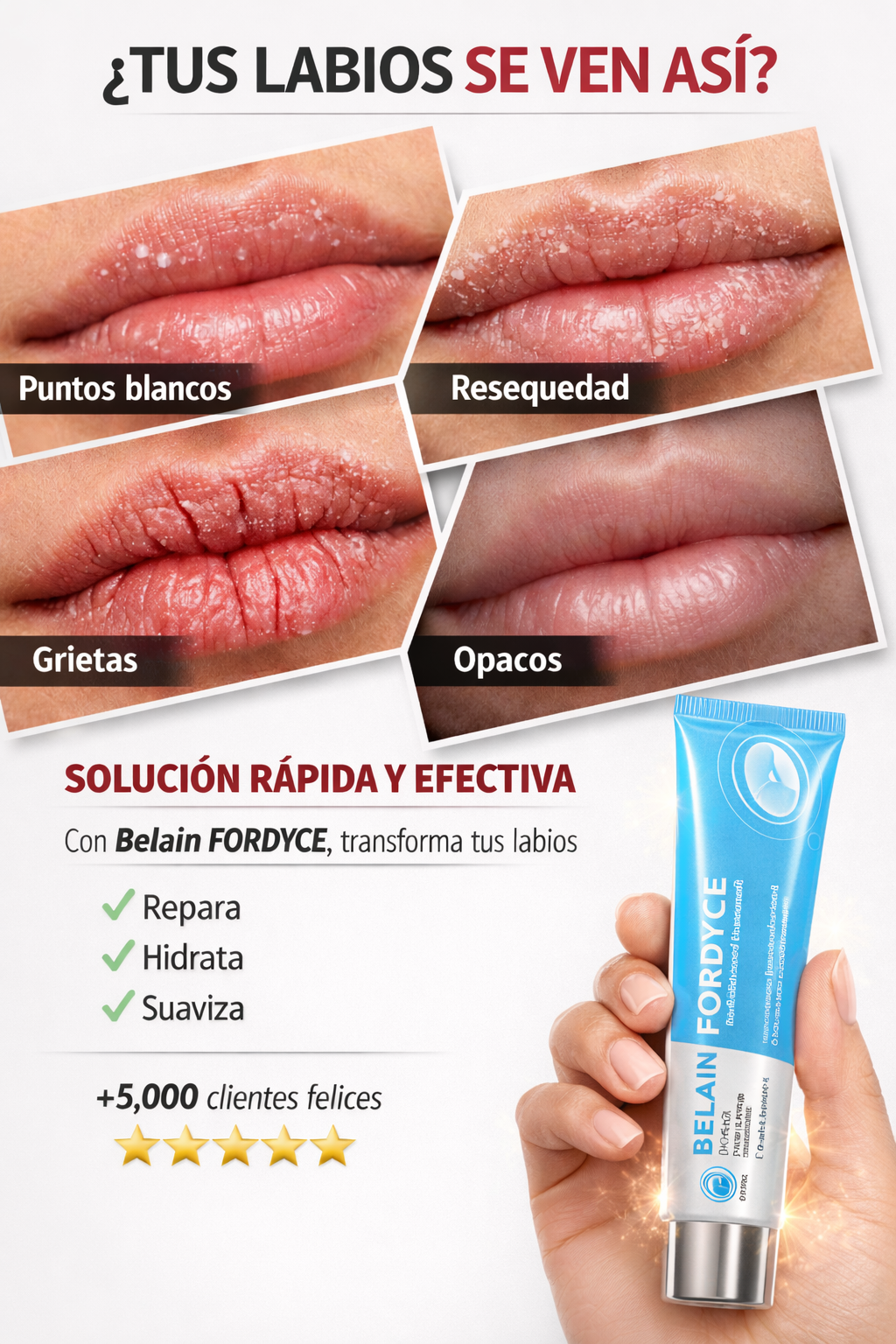 BELANI FORDYCE BÁLSAMO LABIAL| REDUCE LOS PUNTOS BLANCOS, REDUCE LAS MANCHAS E HIDRATA PROFUNDAMENTE